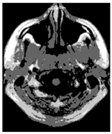 Applsci 15 02355 i016