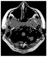 Applsci 15 02355 i022