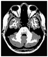 Applsci 15 02355 i026