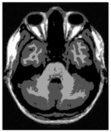 Applsci 15 02355 i027