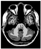 Applsci 15 02355 i028