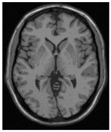 Applsci 15 02355 i031