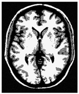 Applsci 15 02355 i032