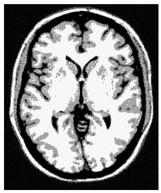 Applsci 15 02355 i033