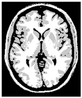 Applsci 15 02355 i034