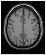 Applsci 15 02355 i037