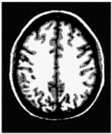 Applsci 15 02355 i038