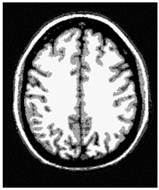 Applsci 15 02355 i039