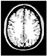 Applsci 15 02355 i040