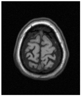 Applsci 15 02355 i043