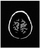 Applsci 15 02355 i044