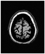 Applsci 15 02355 i045