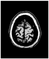 Applsci 15 02355 i046