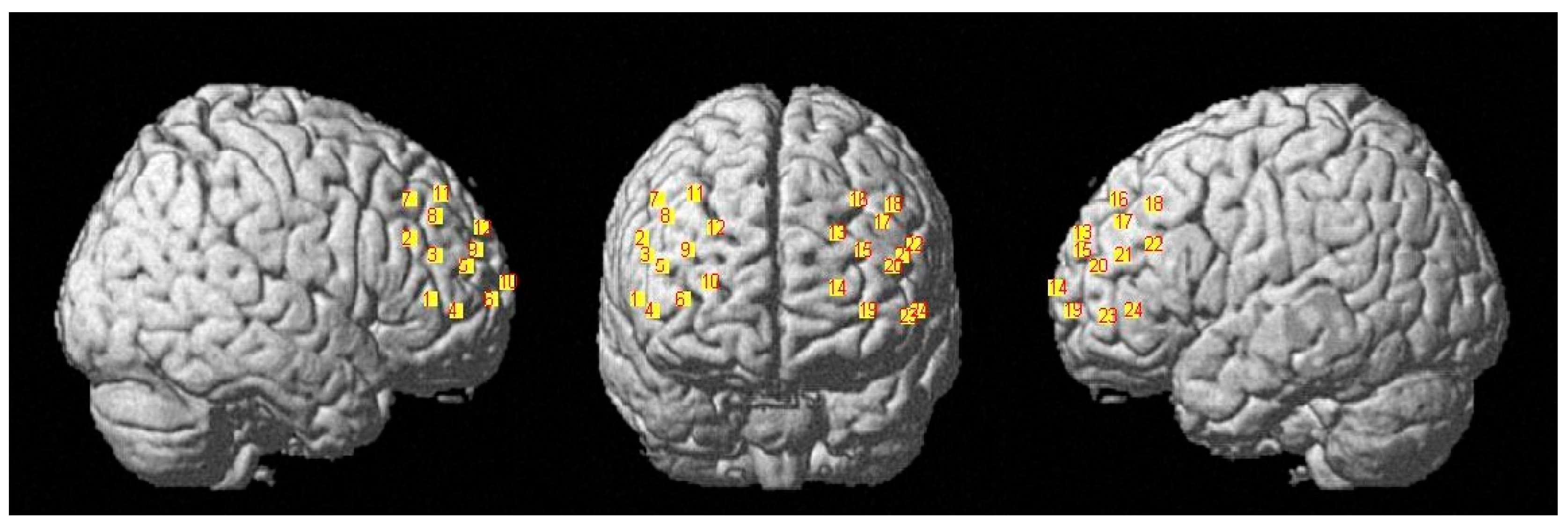 Applsci 15 02464 g005