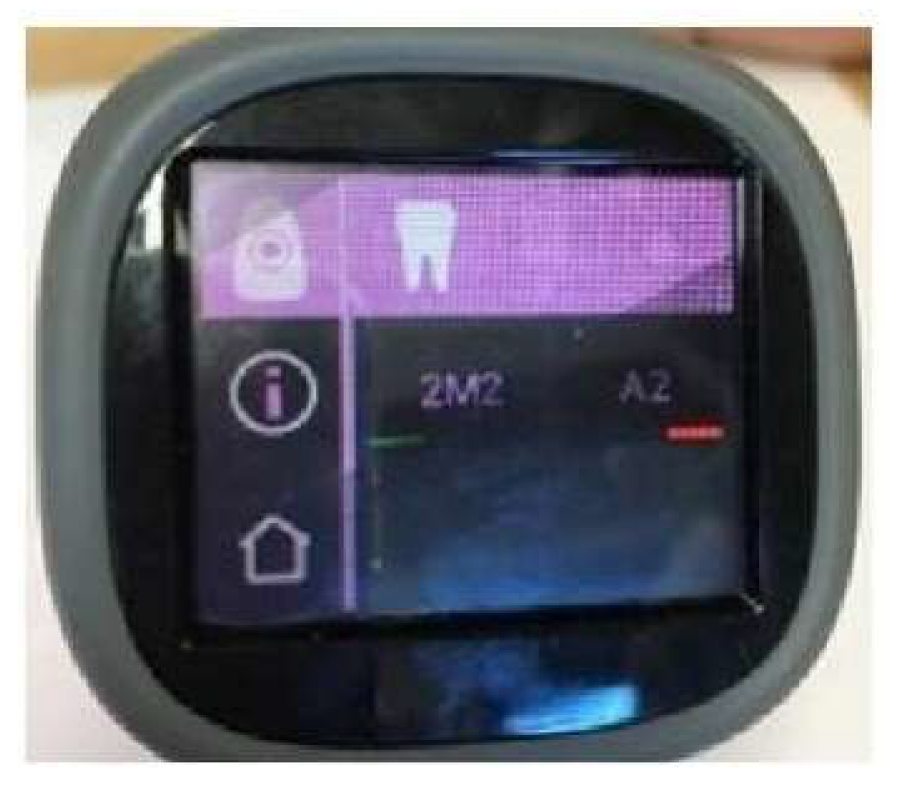 Applsci 15 04160 g003