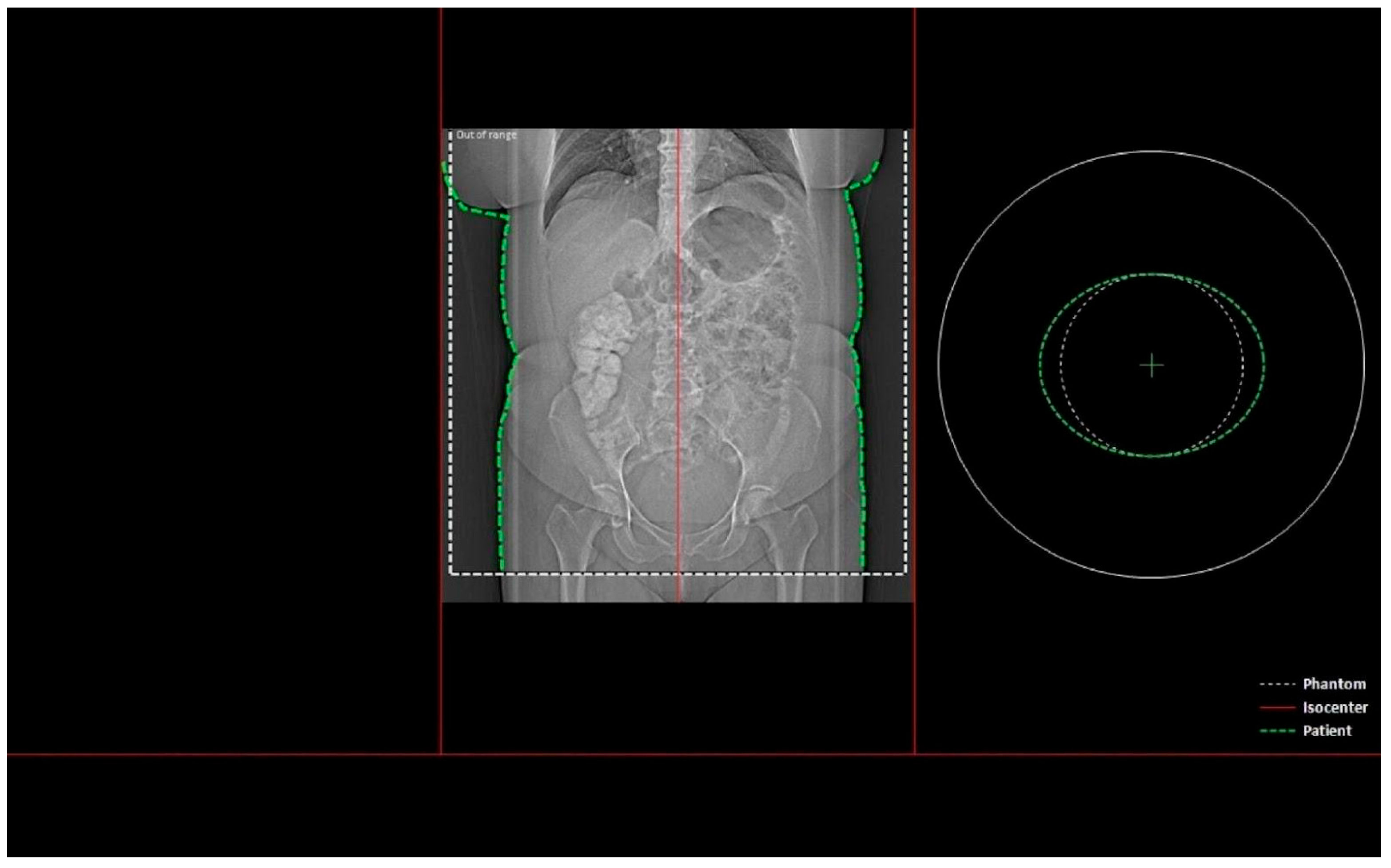 Applsci 15 05815 g001