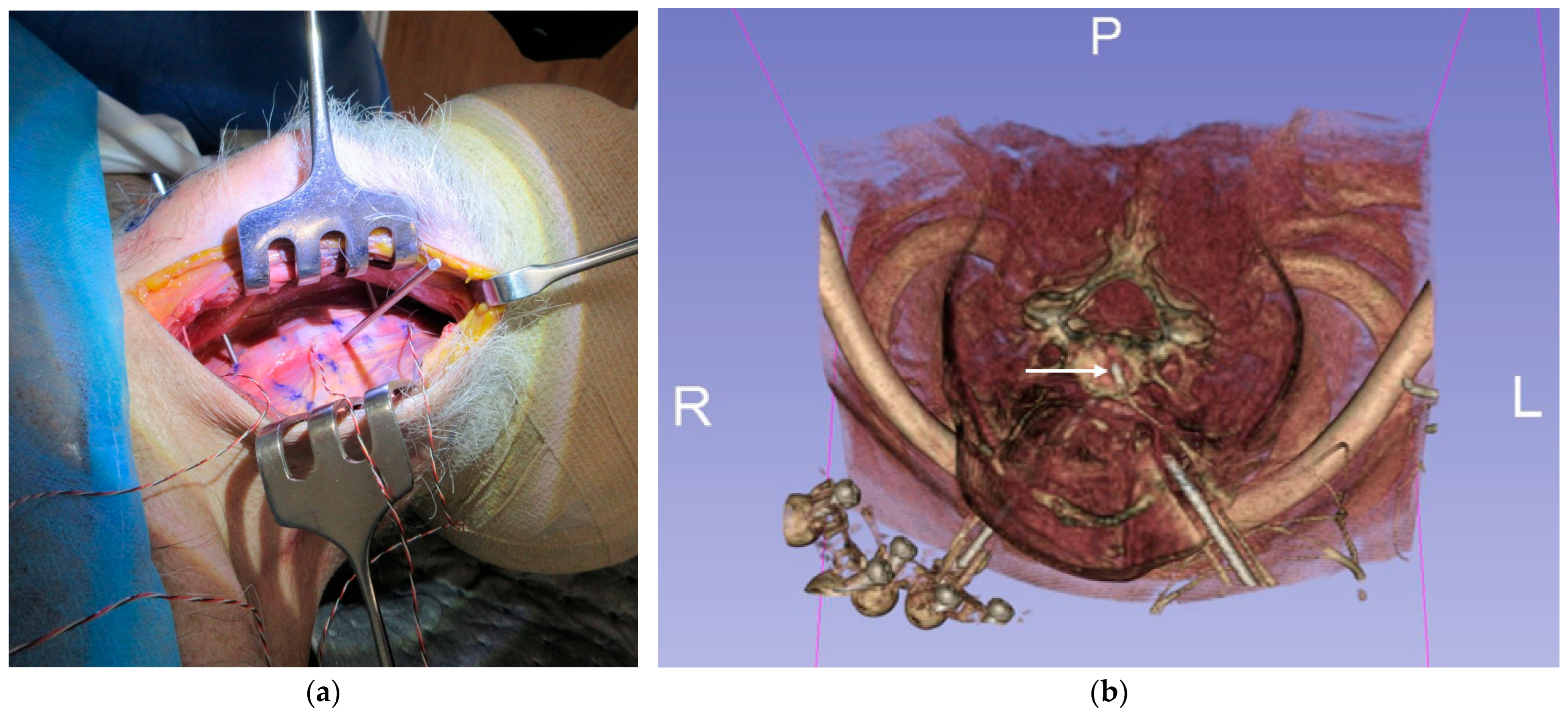 Applsci 15 06167 g001