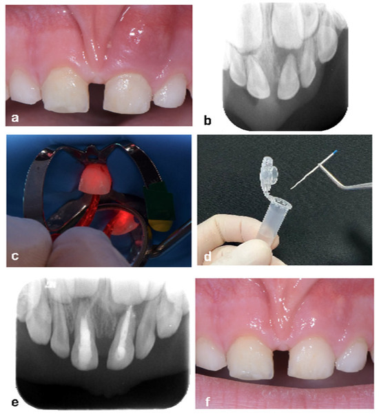 Applsci 15 06491 g002