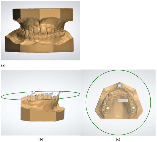 Applsci 15 06515 g001