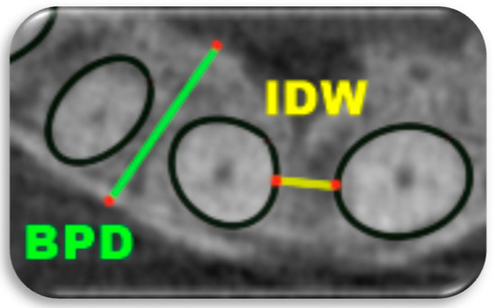 Applsci 15 06866 g003