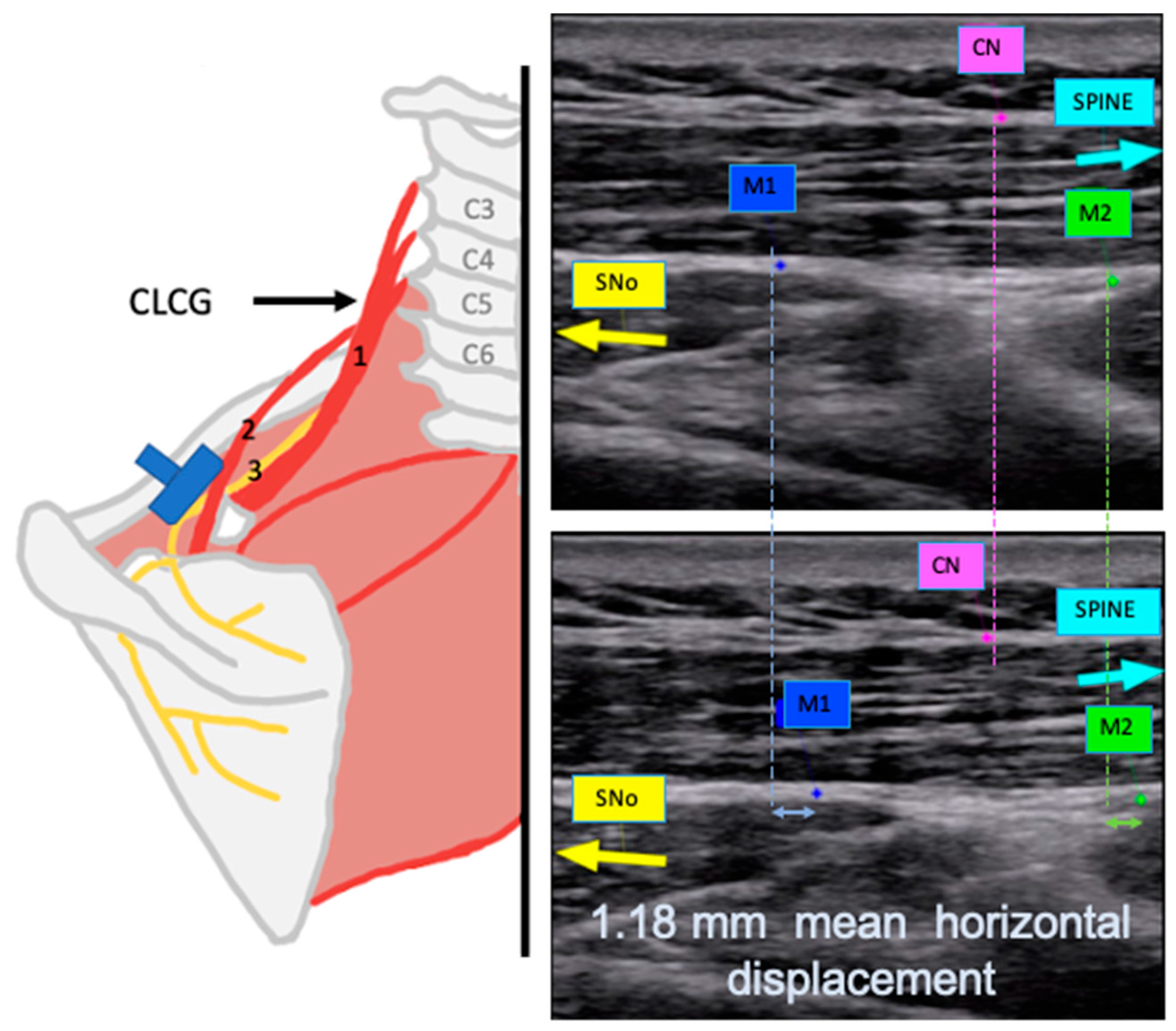 Applsci 15 06987 g004