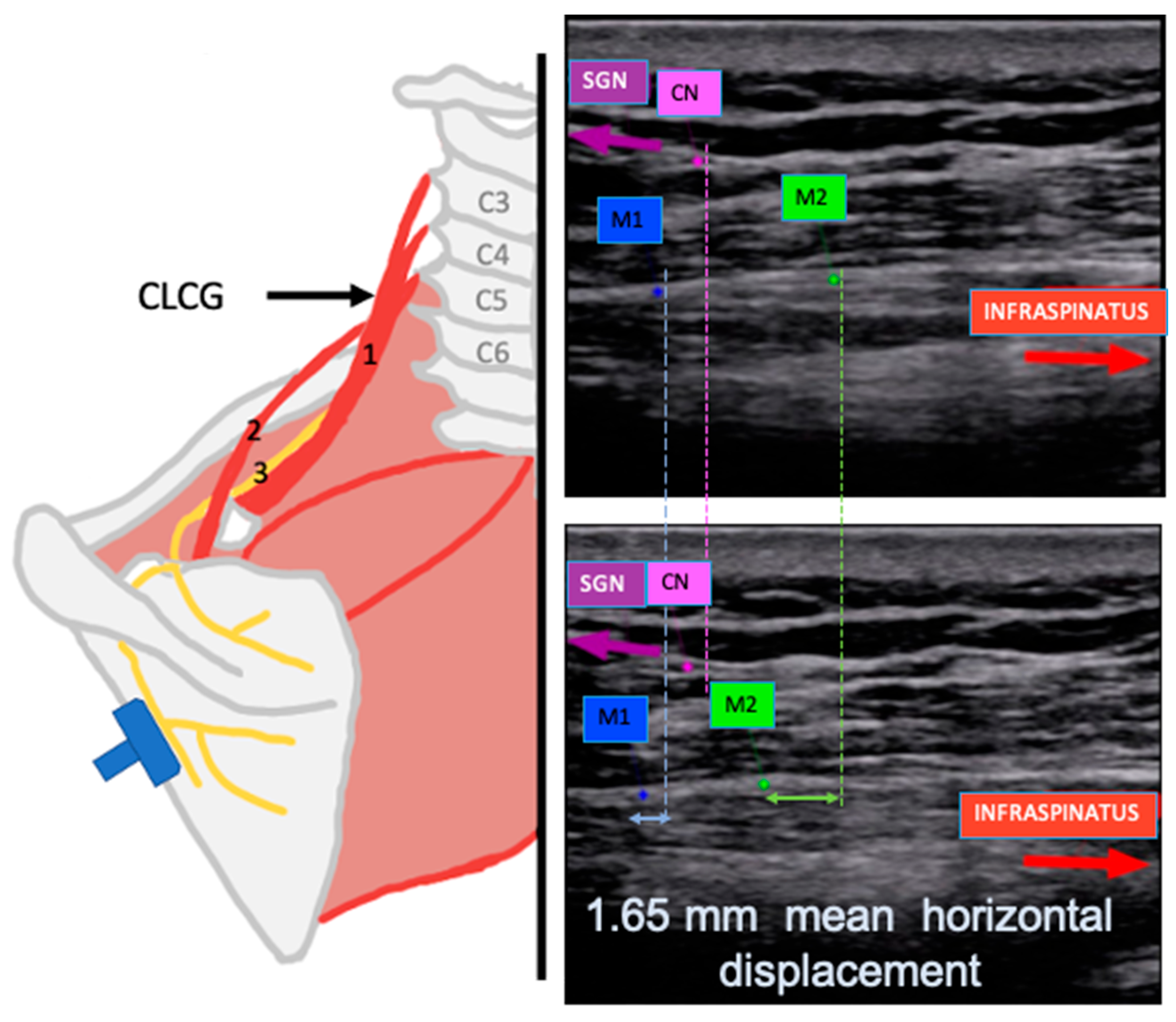 Applsci 15 06987 g005