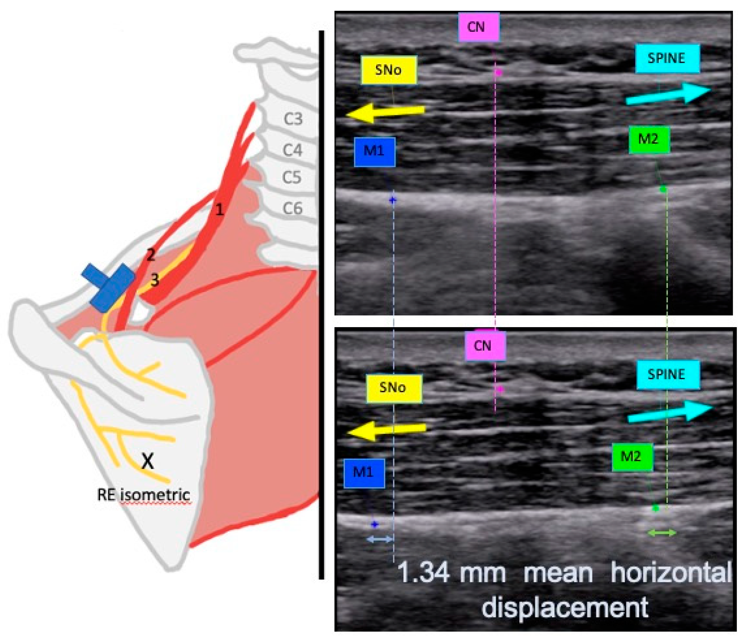 Applsci 15 06987 g006