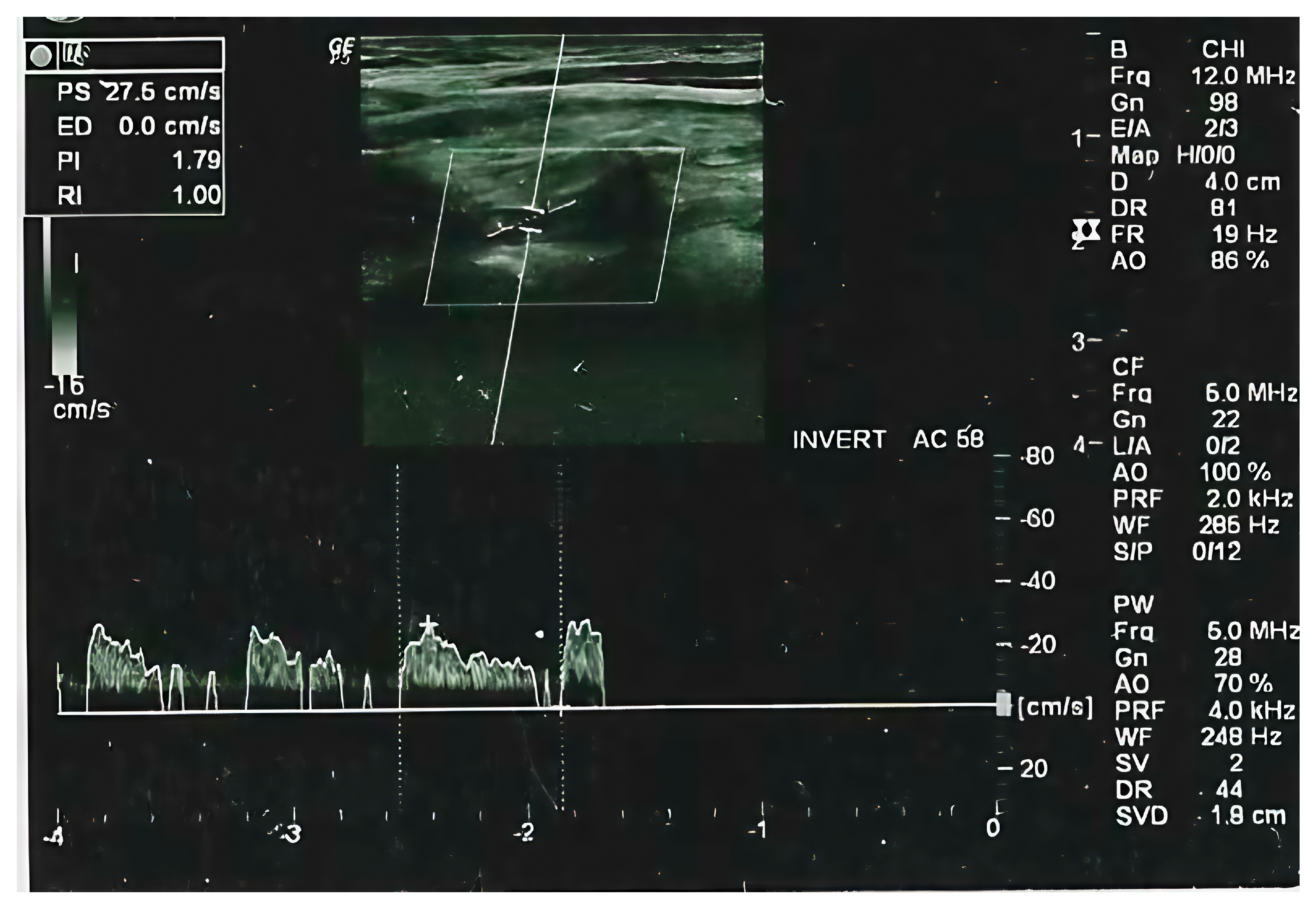 Applsci 15 07890 g002