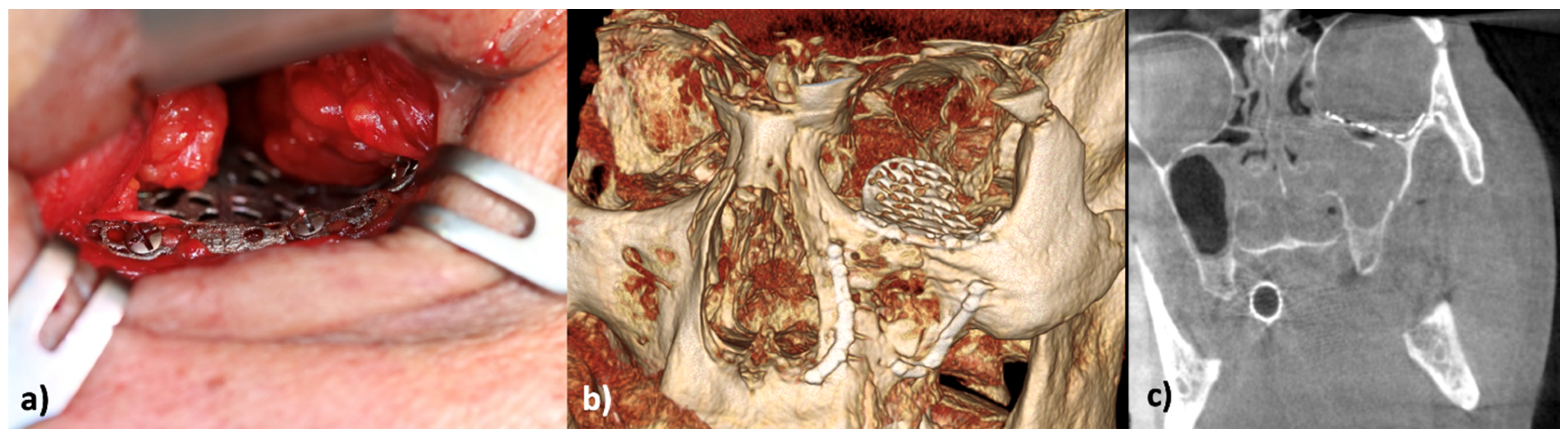 Applsci 15 10194 g005 Applsci 15 10194 g005
