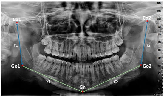 Applsci 15 10802 g001 Applsci 15 10802 g001