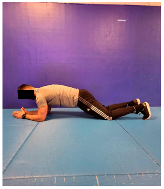 Front support exercise on the forearms (“prone plank”).