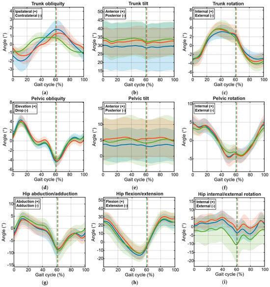 Joint kinematic profiles during the gait cycle for athletes (blue), former athletes (red) and sedentary (green) participants. Curves are represented as mean (solid line) ± standard deviation (shaded regions). Vertical dashed lines indicate the mean toe-off for for athletes (blue), former athletes (red) and sedentary (green) participants; those for athletes and sedentary participants overlap. The following angular patterns are represented: trunk obliquity (a), trunk tilt (b) and trunk rotation (c), pelvic obliquity (d), pelvic tilt (e) and rotation (f), hip abduction/adduction (g), hip flexion/extension (h) and internal/external rotation (i), knee flexion/extension (j), ankle dorsiflexion/plantarflexion (k) and foot progression (l).
