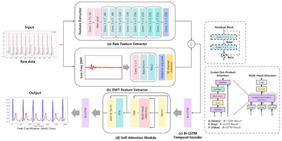 Qrs Complex Block QTANet: Boundary-Aware Deep Learning for Single-Lead QT-Interval ...