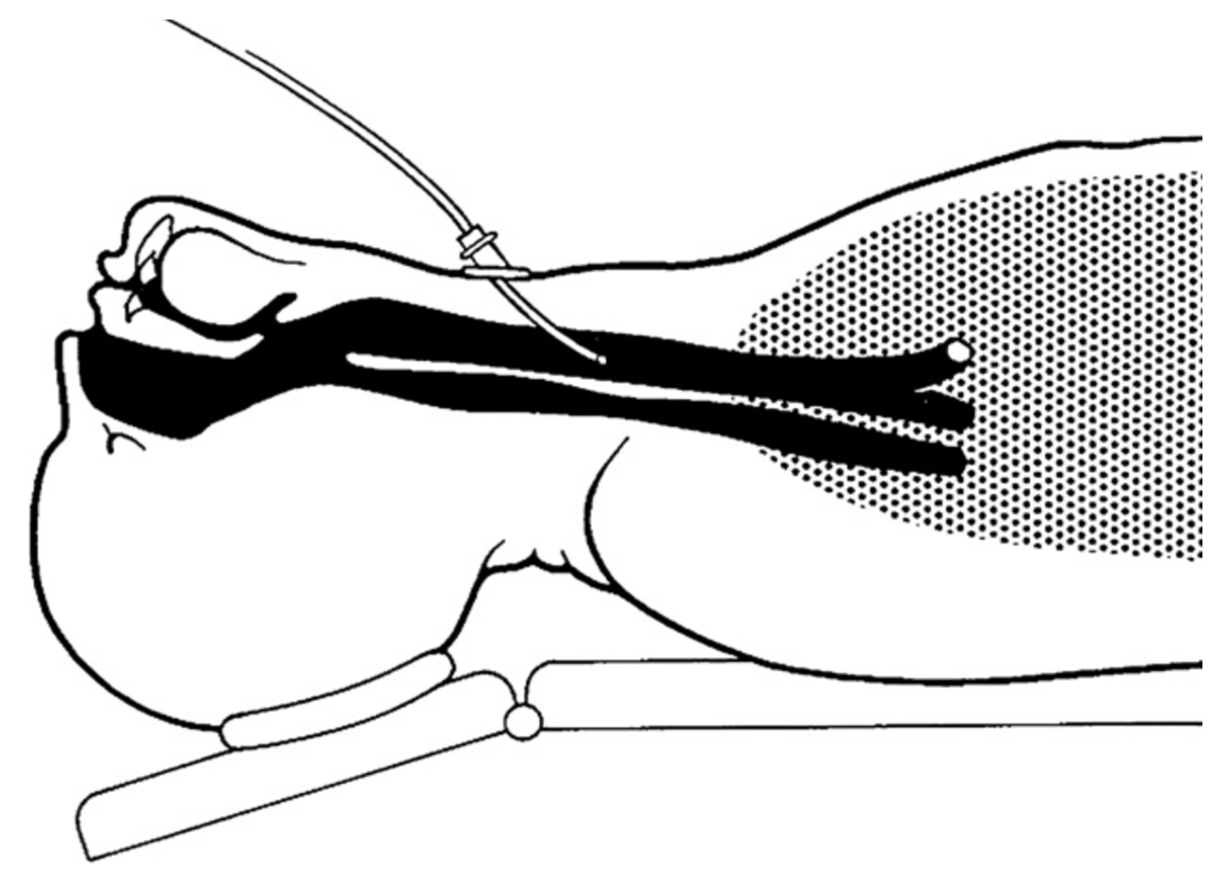 Arm 91 00022 g005 Arm 91 00022 g005