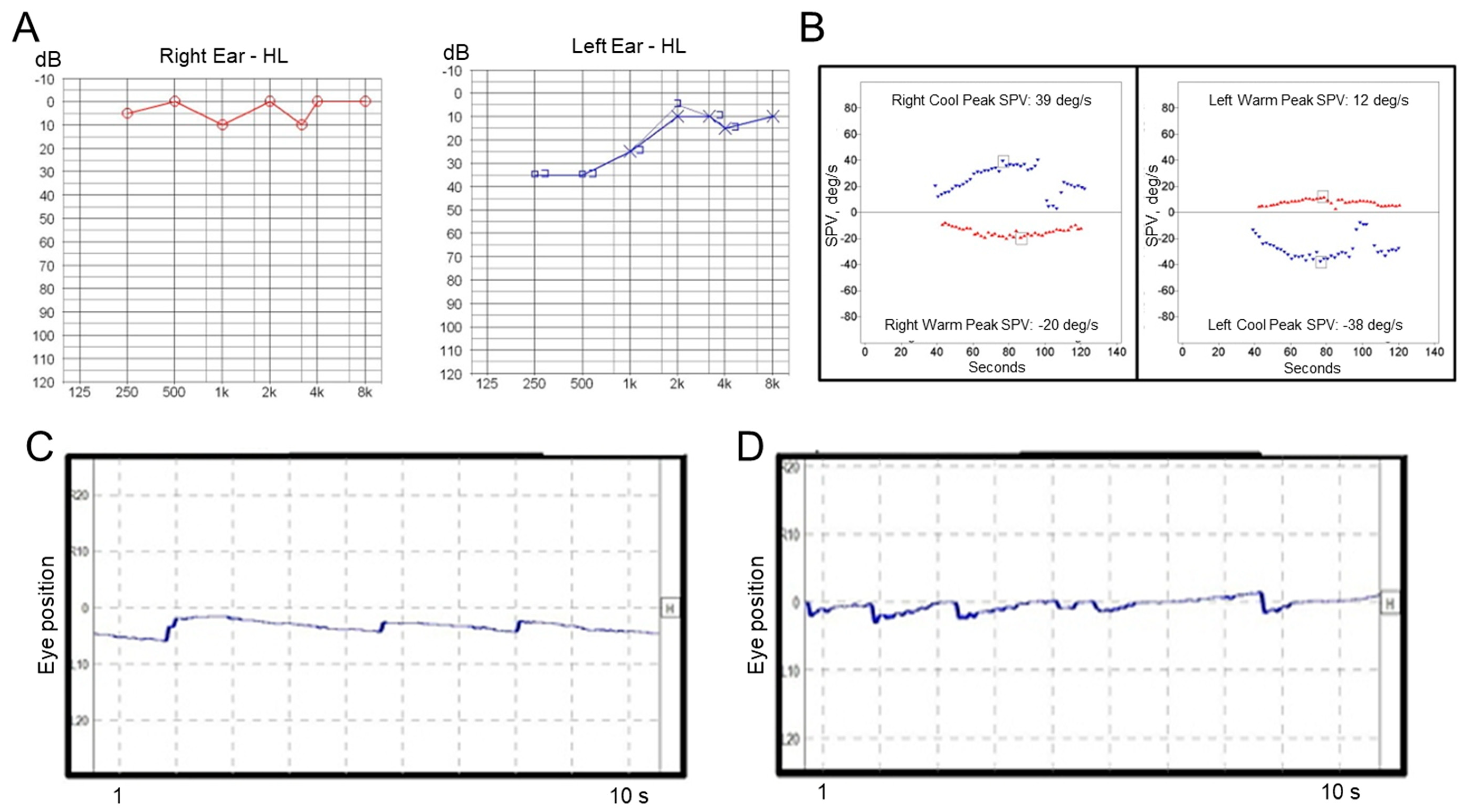 Audiolres 11 00007 g001