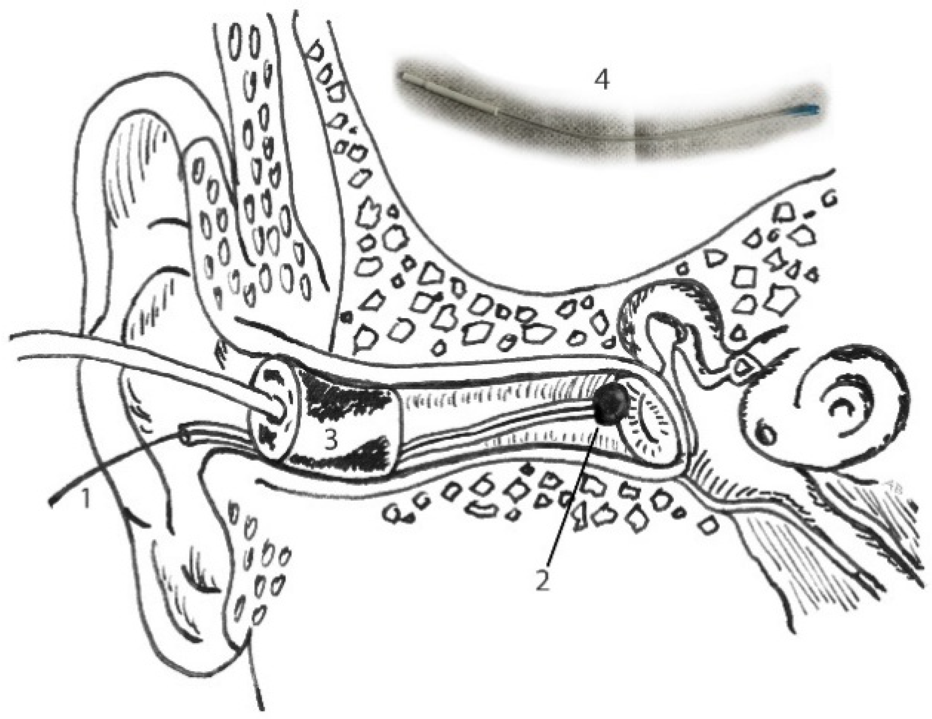 Audiolres 11 00010 g002