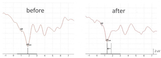 Audiolres 11 00010 g0a1