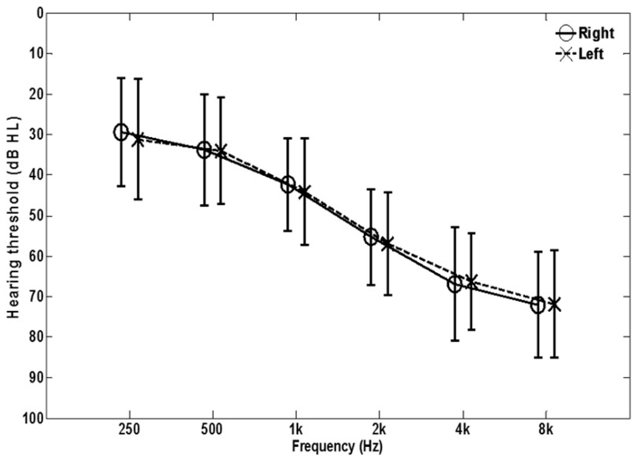 Audiolres 11 00013 g001