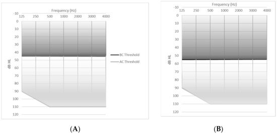 Audiolres 11 00019 g001a Audiolres 11 00019 g001a