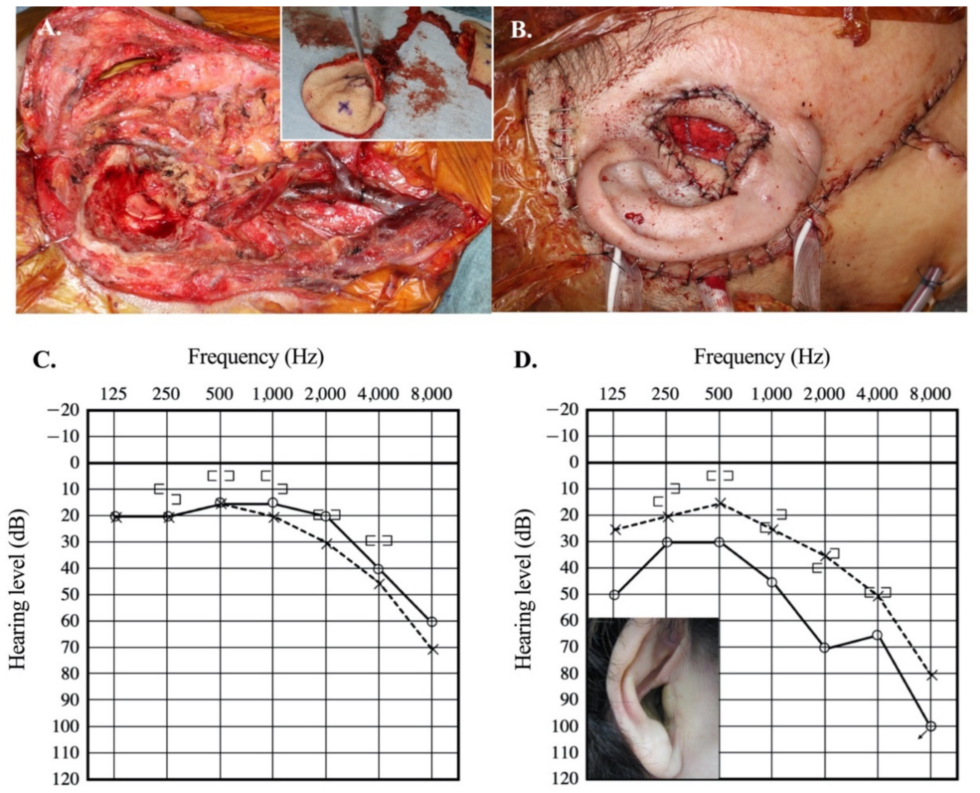 Audiolres 11 00024 g001 Audiolres 11 00024 g001