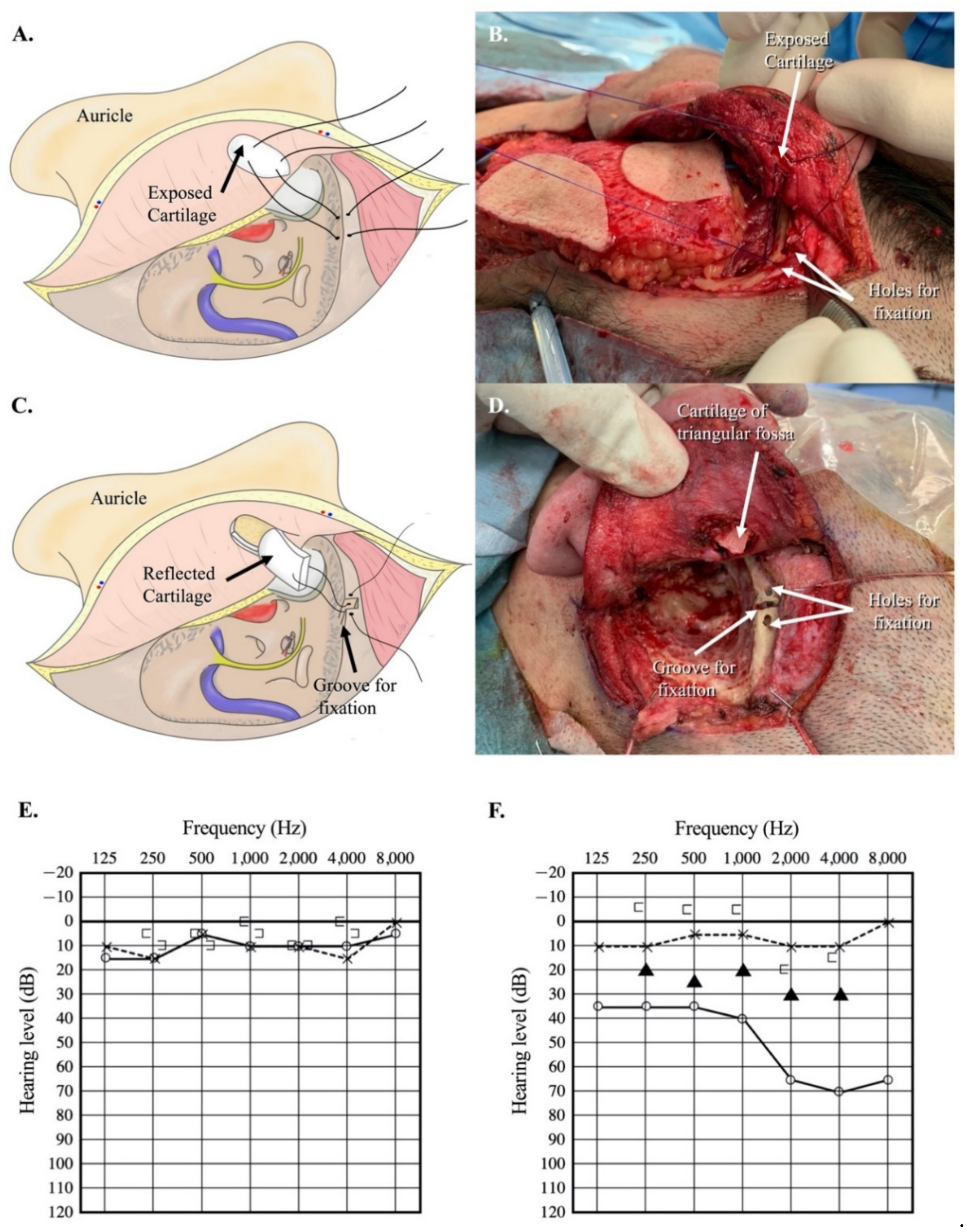 Audiolres 11 00024 g004 Audiolres 11 00024 g004