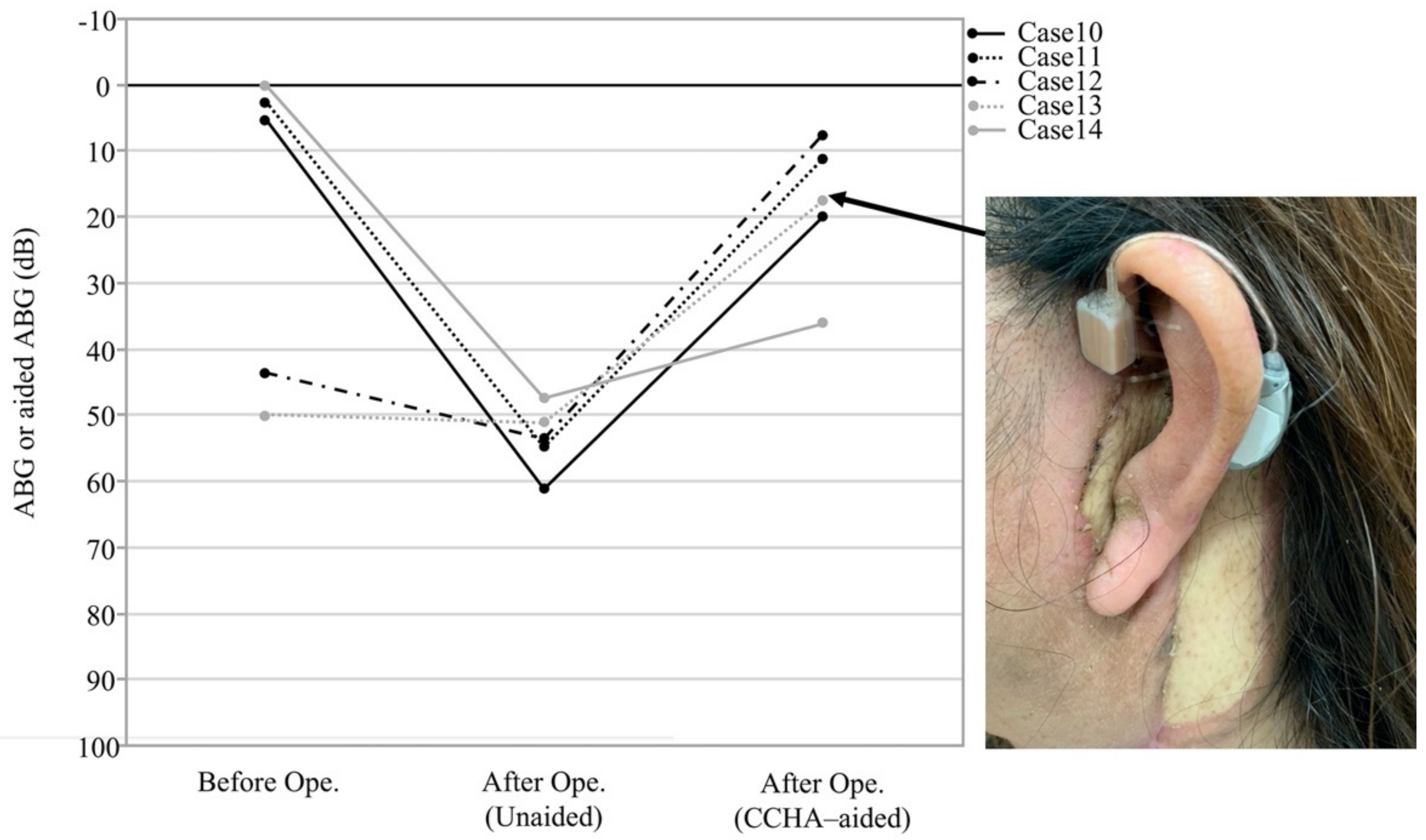 Audiolres 11 00024 g005 Audiolres 11 00024 g005