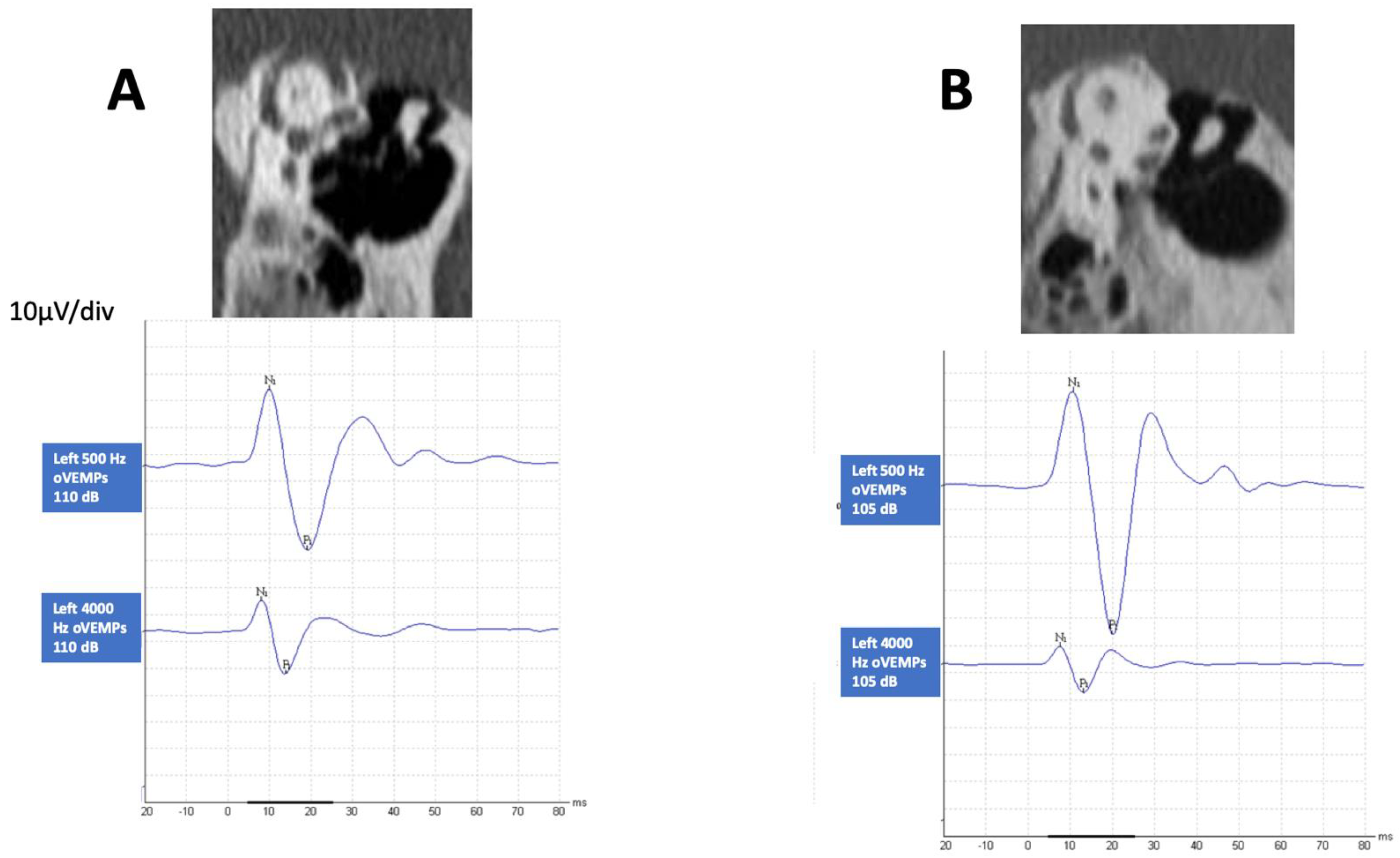 Audiolres 12 00023 g001