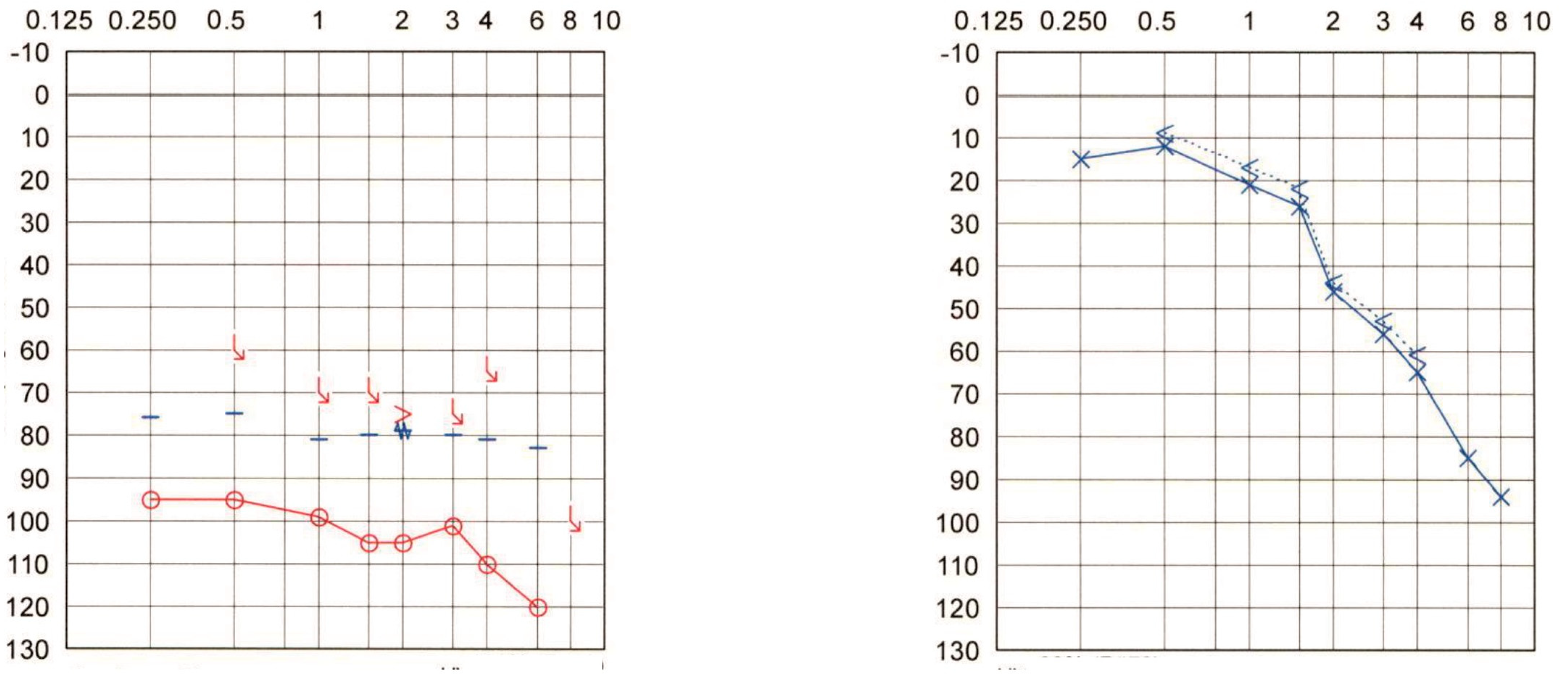 Audiolres 12 00036 g001