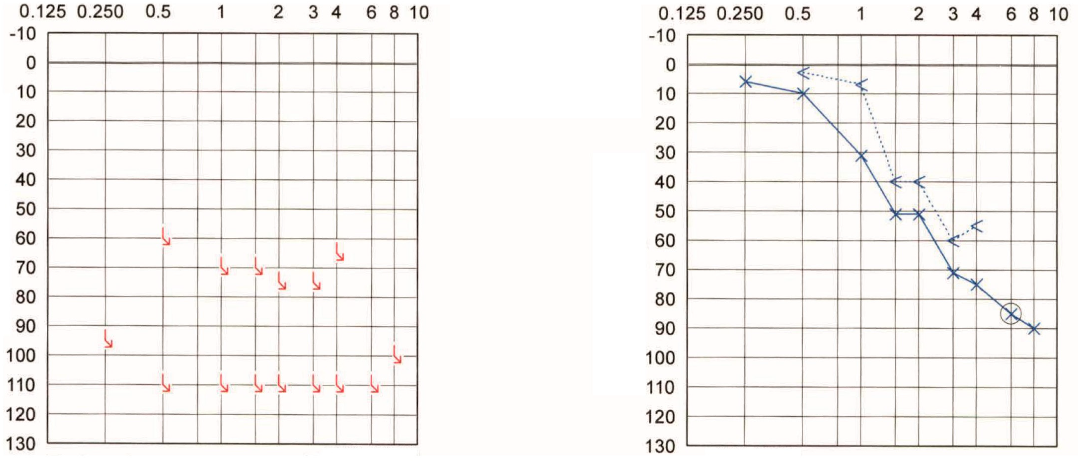 Audiolres 12 00036 g002