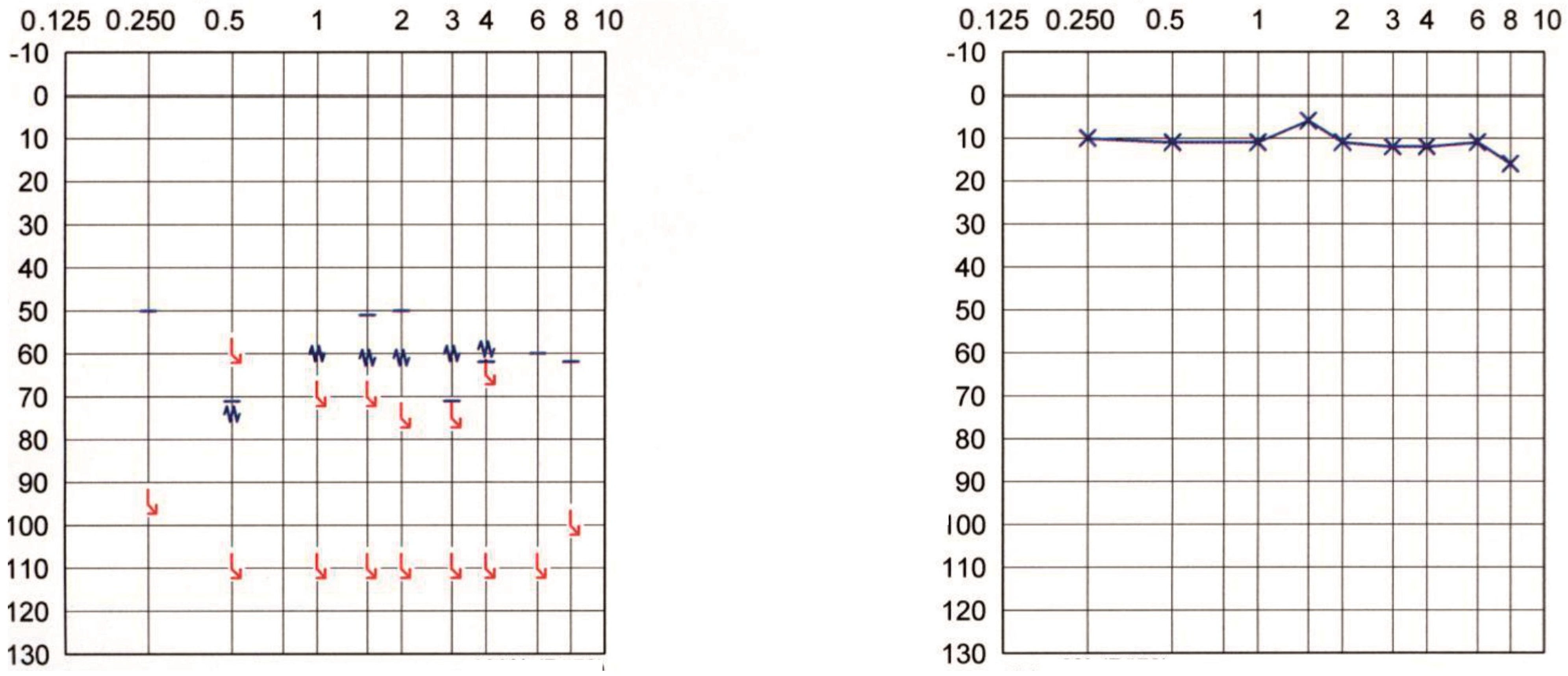 Audiolres 12 00036 g003