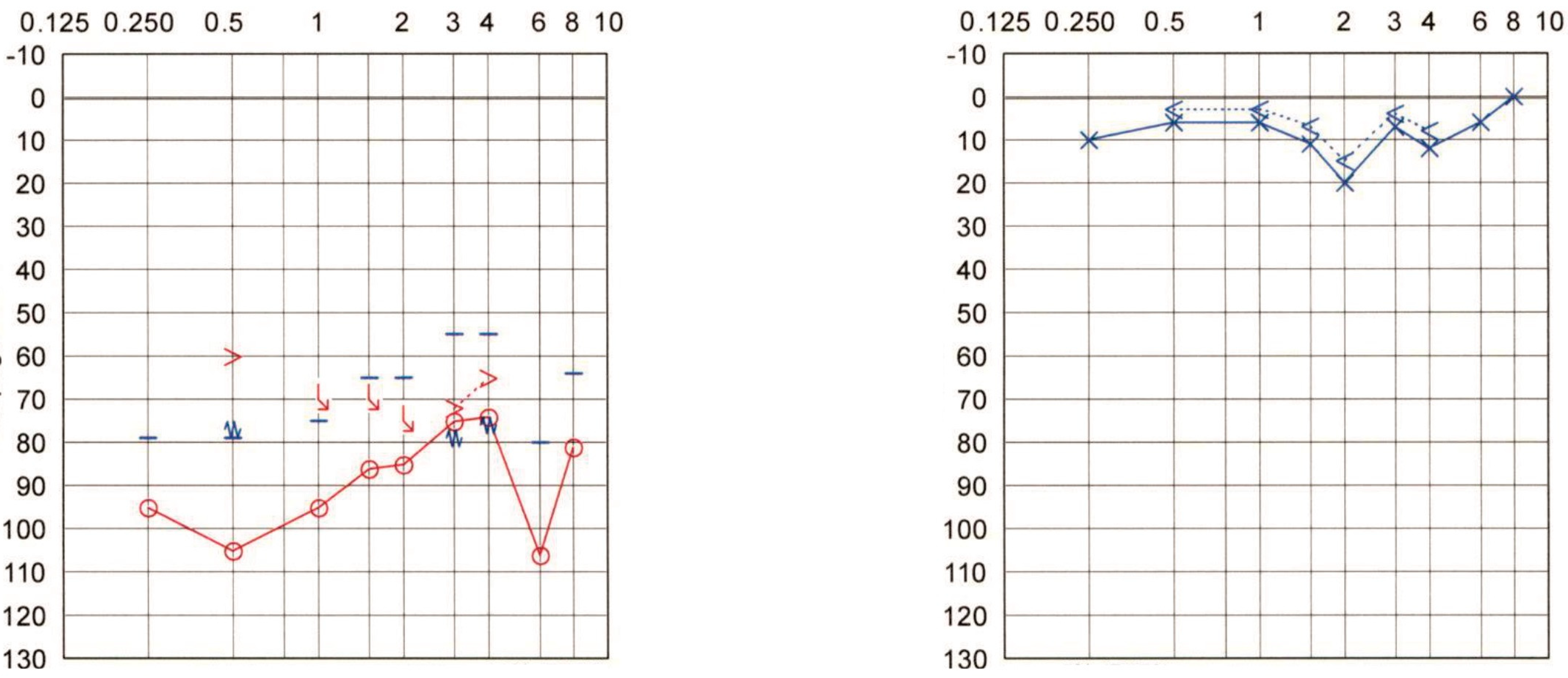Audiolres 12 00036 g004