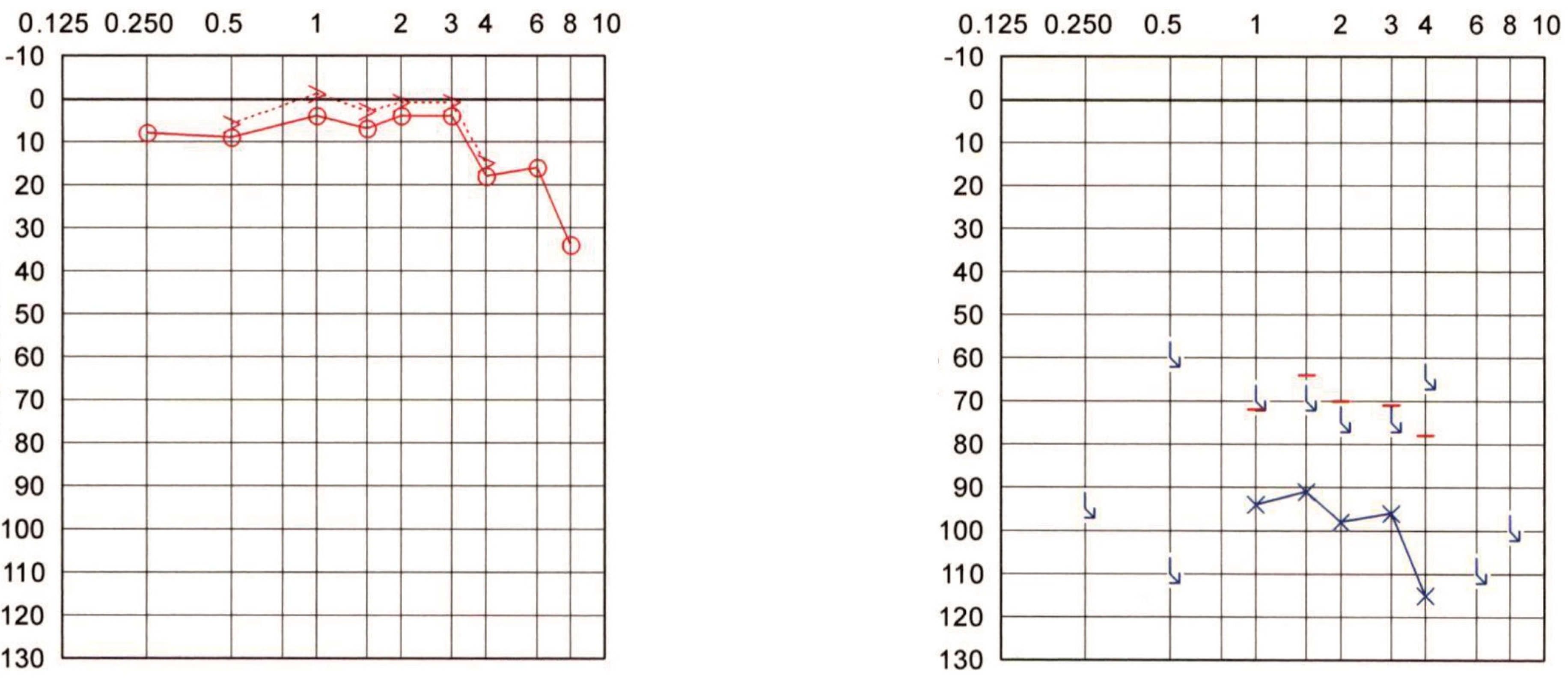 Audiolres 12 00036 g005