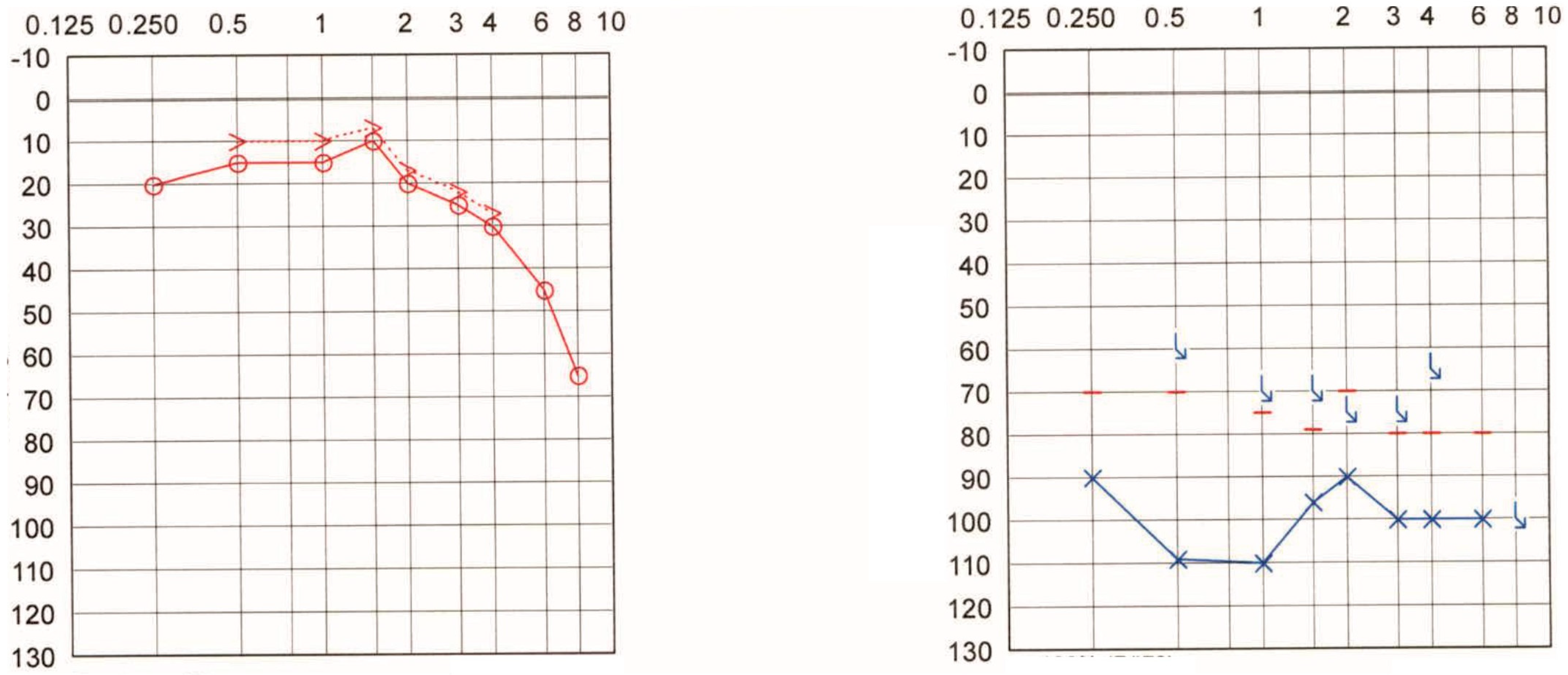 Audiolres 12 00036 g006