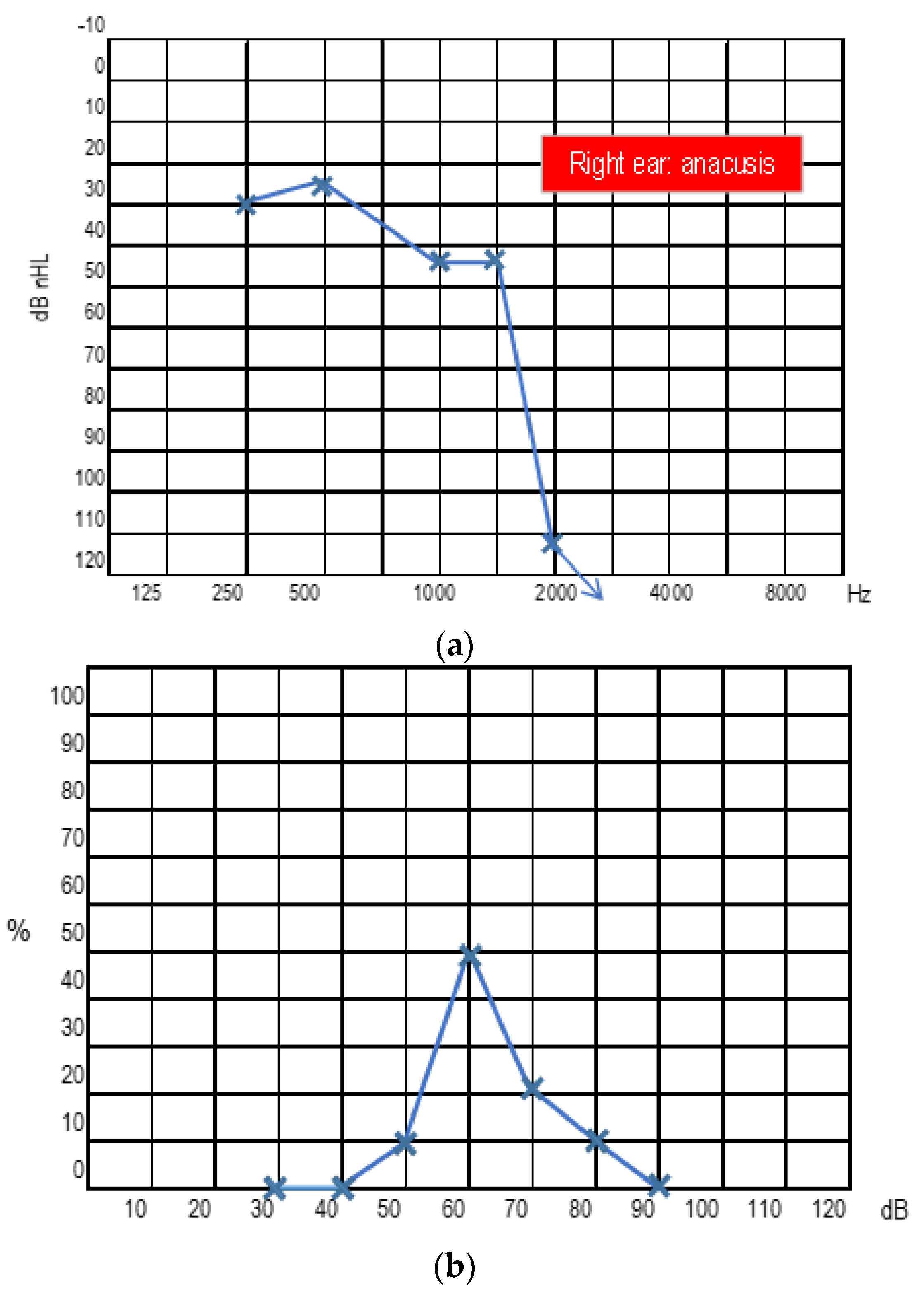 Audiolres 13 00017 g003